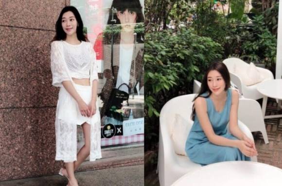 대만의 인기 모델이 프로포폴 투여 후 뇌사 상태에 빠져 19일 만에 사망했다. SNS 캡처