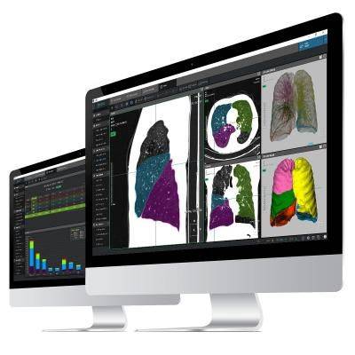 코어라인소프트는 북미영상의학회(RSNA) 2018에서 세계 최초로 만성폐쇄성폐질환 진단에 필요한 폐 영상 분석을 AI를 활용해 완전 자동화한 솔루션 ‘에이뷰 메트릭(AVIEW Metric)’을 발표했다.(사진=코어라인소프트)