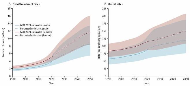 사진은 (왼쪽부터) 1990년부터 2050년까지 황반변성으로 인한 시력 저하의 발생 건수(A) 및 발생률(B). (사진=경희대 제공) *재판매 및 DB 금지