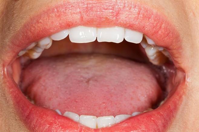 입속 점막에 난 상처는 얼굴이나 팔다리 등 다른 부위에 난 상처보다 회복이 빠르고 흉터가 덜 형성된다. 게티이미지뱅크 제공