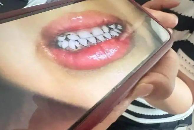 중국 간쑤성의 한 사립 유치원의 원생들이 이상 증세를 보이며 집단 납중독을 진단 받았다. 검사 결과 일부 아동의 혈중 납 농도는 기준치를 최대 4.5배 넘은 것으로 나타났다. ⓒ뉴스1