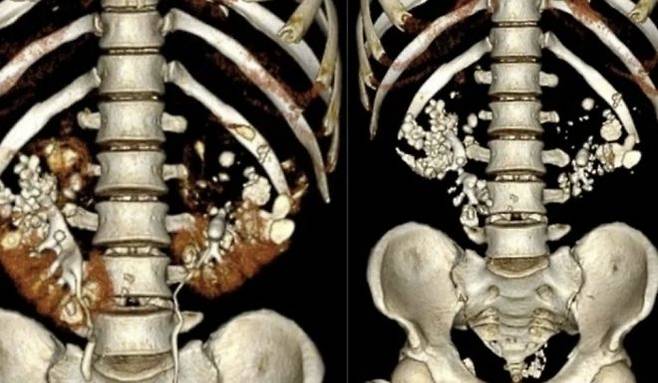 /사진=VN익스프레스