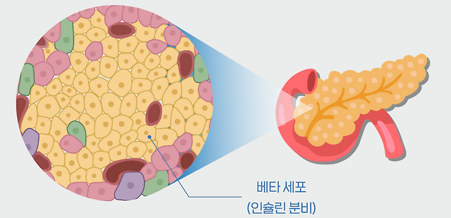 두 종류의 당뇨병 치료제를 함께 투여하면 인슐린을 분비하는 췌장의 베타세포 기능이 회복될 수 있다는 연구 결과가 나왔다. 대한당뇨병학회 제공