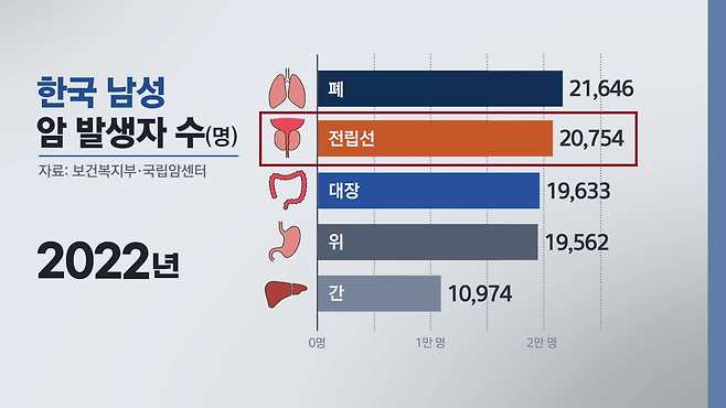 2013년 1만 명을 밑돌았던 전립선암 발생은 10년 뒤 2만 명을 넘어 한국 남성 암 발생 2위를 기록하고 있다.
