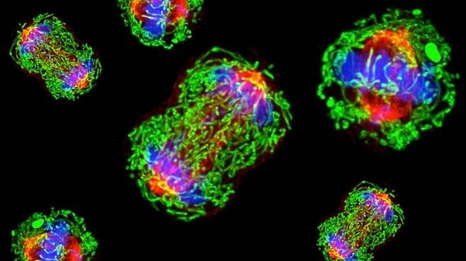 삼중음성유방암은 표적 항암제가 작용하는 3가지 수용체가 모두 없는 악성 유방암이다. 여성 암 중 전이나 재발 위험이 커 최악의 암으로 알려져 있다. 사진은 삼중음성유방암 세포를 전자현미경으로 촬영한 것. 미국 MD 앤더슨 암센터 제공
