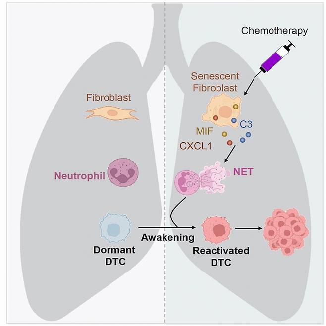 중국 연구팀은 휴면 상태 암세포를 연구하기 위해 개발한 새로운 계통 추적 시스템 ‘돔 트레이서’(Dorm Tracer)를 활용, 독소루비신(doxorubicin)과 시스플라틴(cisplatin)을 포함한 항암제가 휴면 유방암 세포를 활성화시키고 폐 전이를 촉진하는 것을 확인했다. 2025.7.3 중국과학원