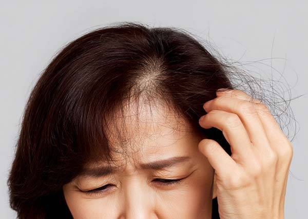 여성 탈모 환자들의 감정 영역의 손상이 두드러졌다며 연구 결과가 나왔다./사진=클립아트코리아