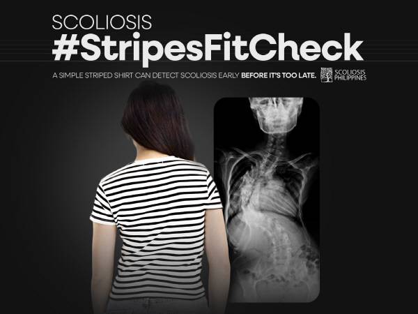 ‘제18회 부산국제마케팅광고제’에서 공익광고 부문 ‘올해의 그랑프리’를 수상한 ‘척추측만증 #줄무늬 티셔츠로 체크해’. 부산국제마케팅광고제 제공