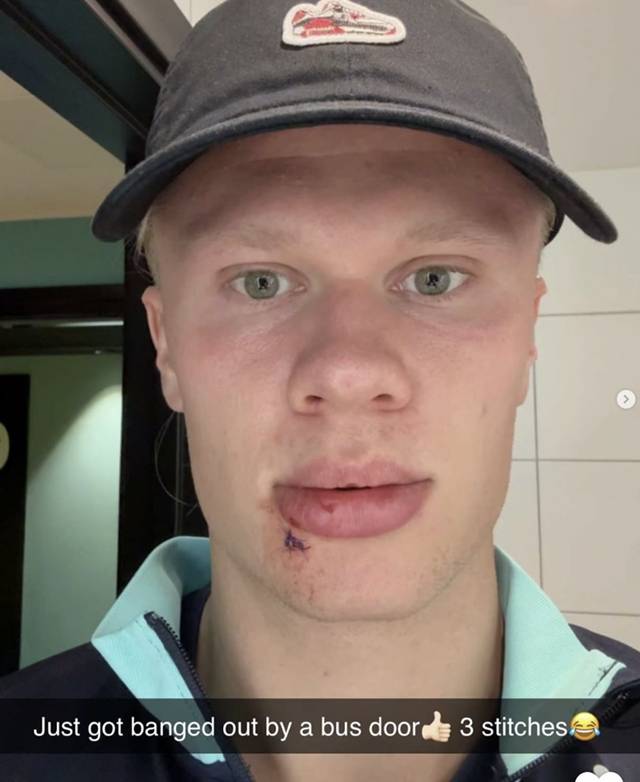 부상을 당한 엘링 홀란. /=사진=433 캡처