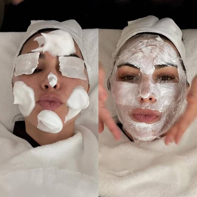 유명 할리우드 스타인 킴 카다시안이 소셜미디어에 올린 사진. 지난 달 서울을 방문해 피부과 시술을 받는 자신의 모습을 찍은 사진이다. /인스타그램