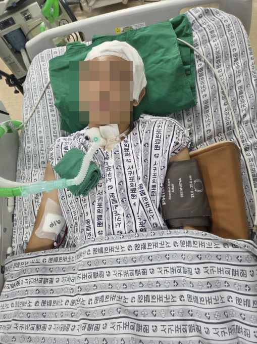 지난 3일 뇌 수술을 받은 조연호 군은 열흘이 다 돼 가는 현재까지 의식을 찾지 못하고 있다. 사진=조연호 군 부모 제공