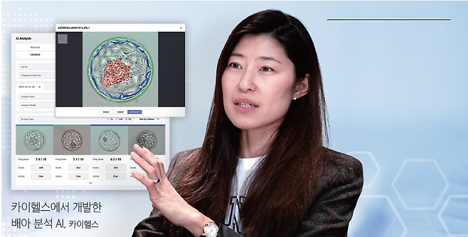 이혜준 카이헬스 대표- 서울대 의대 석·박사, 미 노스웨스턴대 켈로그스쿨 경영학 석사(MBA), 전 사이앱스 아시아·태평양(APAC) 이사, 전 체인지헬스 케어 전략 및 인공지능팀, 전 서울대학교 병원 산부인과 전공의, 전임의 /사진 조선비즈