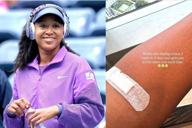 오사카 나오미가 자신의 SNS에 올린 도핑 후 사진