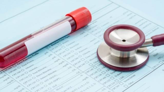 건강검진 결과, 간 수치가 높게 나왔다면 UDCA가 도움 될 수 있다|출처: 클립아트코리아