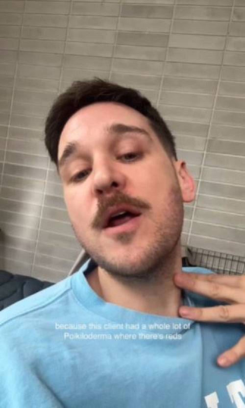 호주 멜버른의 피부과 전문의 제임스 비비안이 향수를 목에 직접 뿌리는 습관이 피부에 치명적인 질환을 유발할 수 있다고 경고했다./사진=제임스 비비안 인스타그램