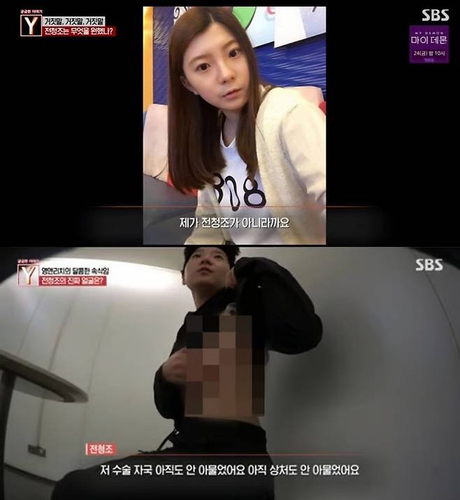 남현희 과거 사진과 인터뷰 도중 가슴절제술을 인증하는 모습. /사진=SBS 시사·교양 '궁금한 이야기 Y'
