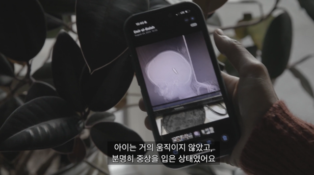 ▲다큐멘터리에 나오는 네 살 소녀 미라 알다리니의 사진. 머리에 총알이 박혀 있다. <포화 속의 아이들> 갈무리. ⓒ알자지라