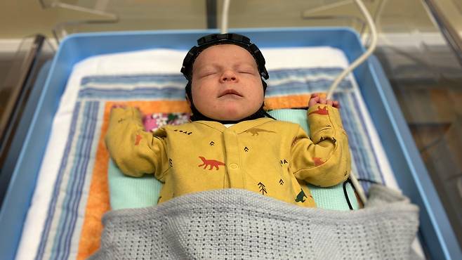 연구진은 빛과 초음파를 활용해 신생아의 뇌를 모니터링하는 일명 "수영모자"를 개발했으며, 이는 세계 최초의 기술이라고 밝혔다