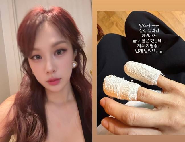 사진=채연 소셜미디어