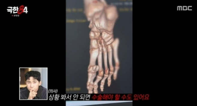 사진제공=MBC 캡처
