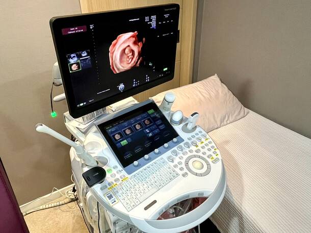 태아의 3차원 모습을 확인할 수 있는 초음파 영사 기기. 염기원 작가 제공