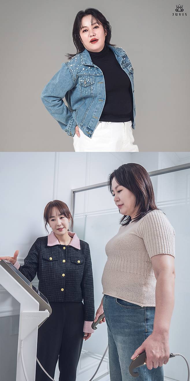 ▲ 김금순. 제공| 쥬비스