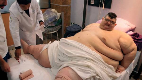 한때 '세계에서 가장 무거운 사람'으로 기네스 세계 기록에 올랐던 멕시코 남성이 신장 감염 합병증으로 숨졌다. 사진은 병원에 입원해 있는 모습./사진=더선
