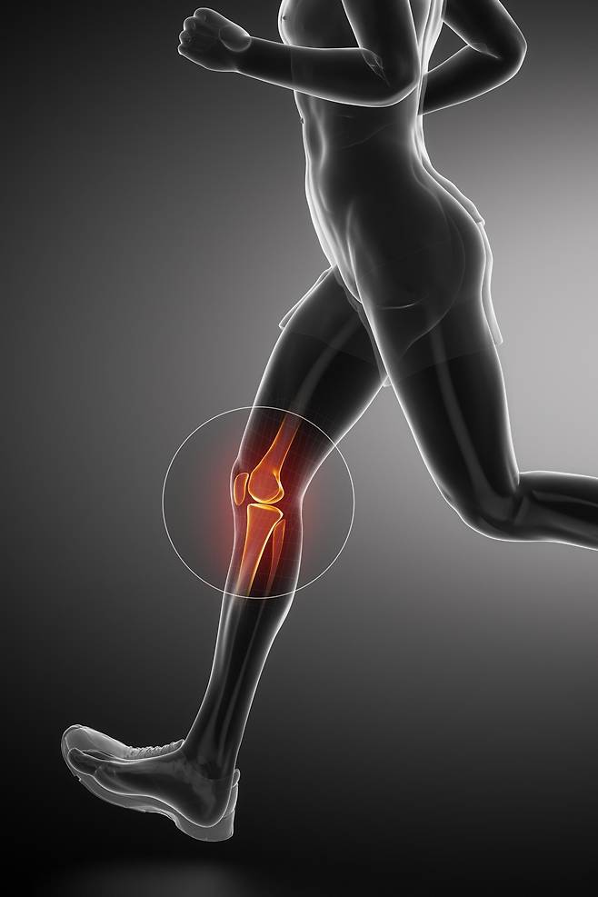 연골이 복원되면 자연스럽게 활동량이 늘고 전반적인 신체 기능 회복으로 이어진다. 게티이미지뱅크