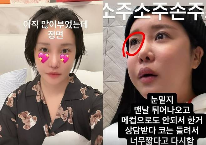 랄랄 소셜미디어