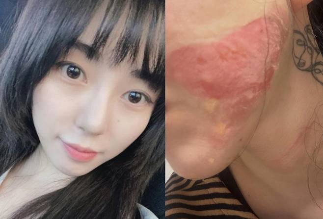 사진=권민아 SNS