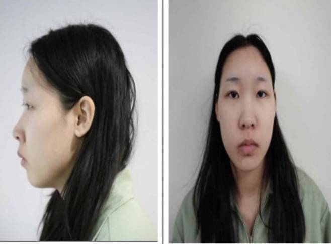 '강북 모텔 연쇄살인' 피의자 김소영/사진=서울북부지검 제공