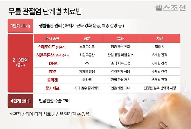 무릎관절염 단계별 치료법 / 그래픽=최우연