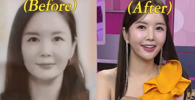 사진=유튜브 채널 ‘A급 장영란’ 캡처