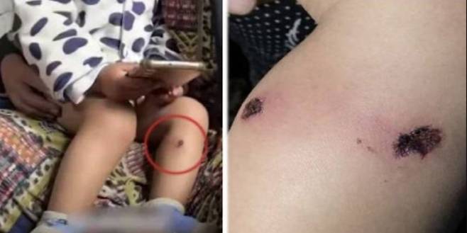 이스라엘군이 팔레스타인 가자지구의 난민캠프 검문소에서 한 팔레스타인 남성에게 자백을 강요하던 중 그의 18개월 아기를 고문했다는 주장이 나왔다. 사진은 피해 영아의 모습. 알자지라 제공