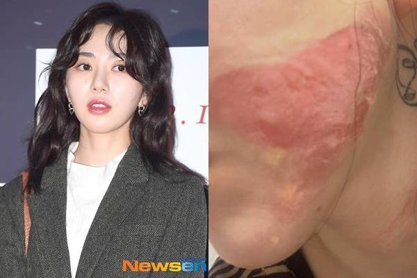 권민아/뉴스엔DB, 권민아 계정 캡처