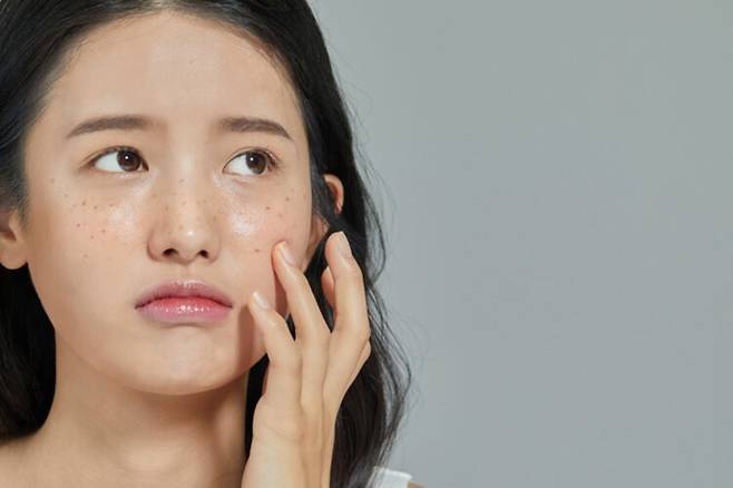 봄에 갑작스럽게 강한 자외선을 받으면 피부에 색소 반응이 쉽게 올라올 수 있다. 사진=게티이미지뱅크