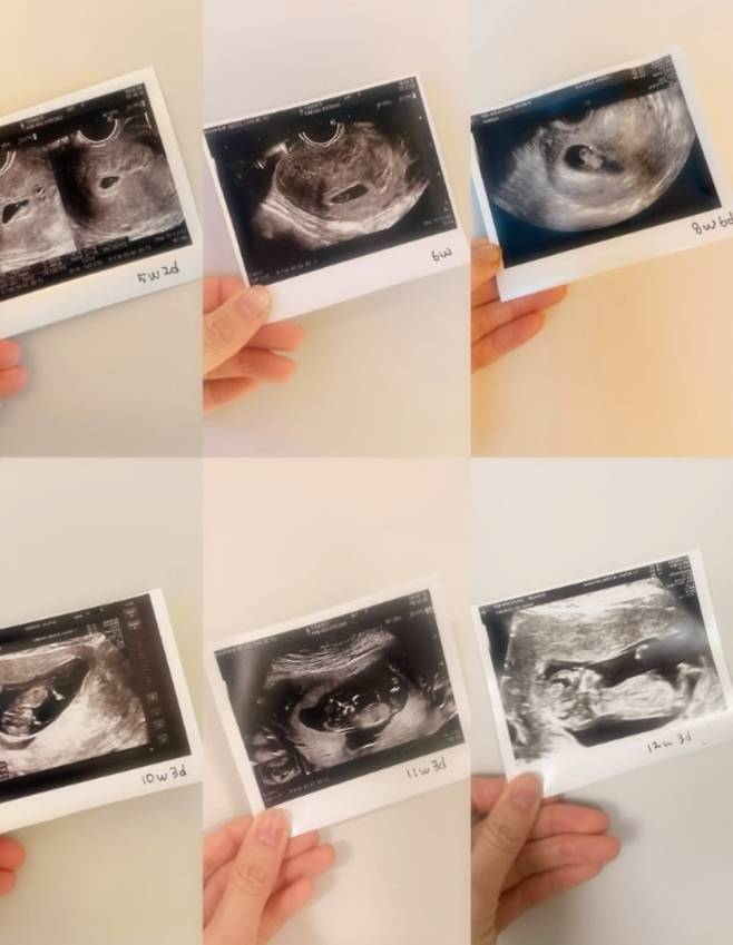 미스코리아 출신 배우 김민경이 임신 사실을 알렸다. / 사진=김민경 SNS