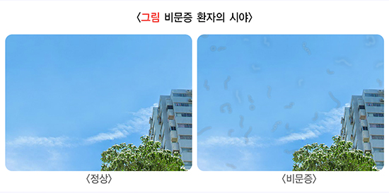 질병관리청