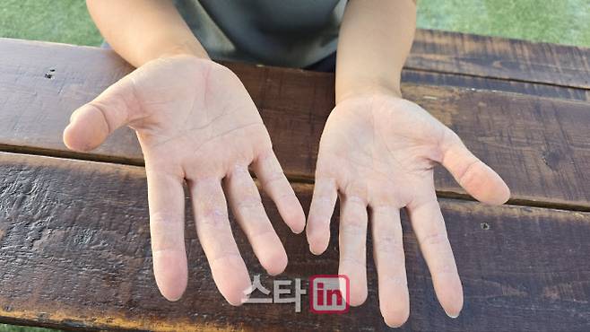 김효주가 턱걸이 훈련으로 굳은살이 박힌 손바닥을 보여주고 있다. (사진=주영로 기자)