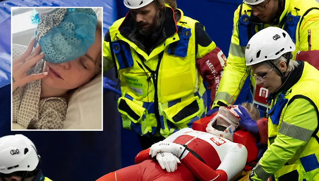 ▲ 이탈리아 밀라노 아이스스케이팅 아레나에서 열린 2026 밀라노ㆍ코르티나담페초 동계올림픽 쇼트트랙 여자 1,500m 준준결승에서 폴란드 카밀라 셀리에르는 산토스-그리즈월드의 스케이트 날에 왼쪽 눈 부위를 긁혀 출혈 증세를 보였고 한동안 일어나지 못하다가 들것에 실려나갔다.