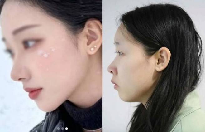 '강북 모텔 약물 사건' 피의자 김소영(20)의 공개된 얼굴(오른쪽)과 그의 것으로 추정되는 SNS 계정 내 사진. SNS 캡처