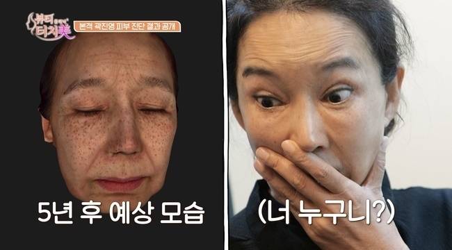 채널A ‘뷰티 클리닉 터치미’
