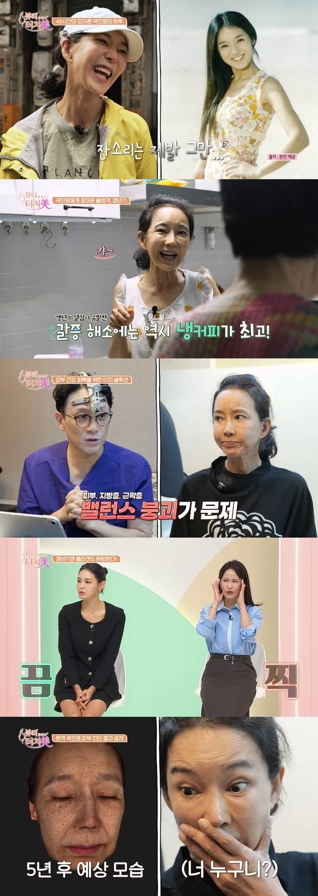 채널A ‘뷰티 클리닉 터치미’