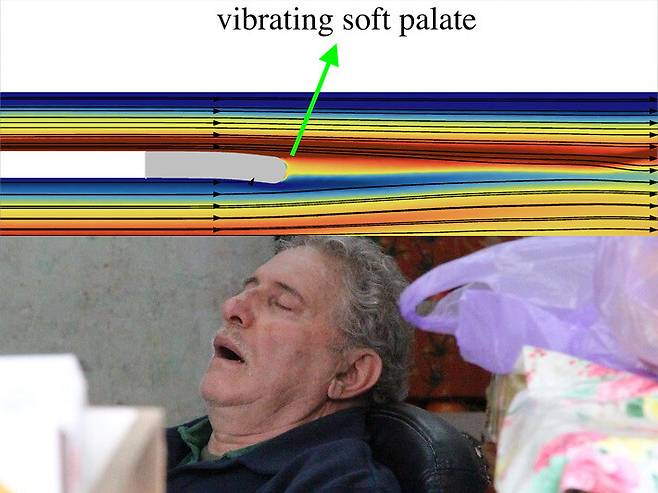 코골이 소리의 발생지인 연구개(soft palate) 위쪽으로 흐르는 공기의 흐름을 표현한 그림. 공기가 일직선으로 부드럽게 지나가지 않고, 연구개를 지나면서 불규칙한 흐름을 보인다. 미국물리학회(AIP) 제공