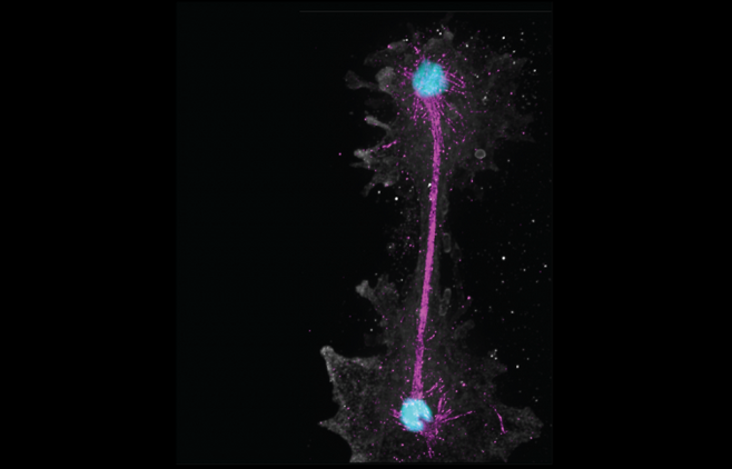 섭씨 63도 온도에서 세포분열하는 신종 아메바 '인센디아메바 카스카덴시스(Incendiamoeba cascadensis)' 세포의 모습. 파란색은 디옥시리보핵산(DNA), 분홍색은 세포분열 과정에서 염색체를 나누는 미세소관을 구성하는 단백질 '튜불린', 회색은 세포막이다. Felix Mikus 제공