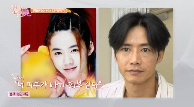 사진=채널A ‘뷰티 클리닉 터치미’ 캡처