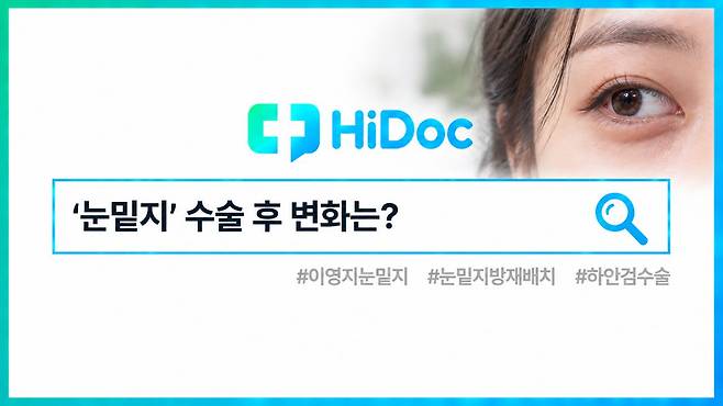 이영지 눈밑지ㅣ출처: 하이닥